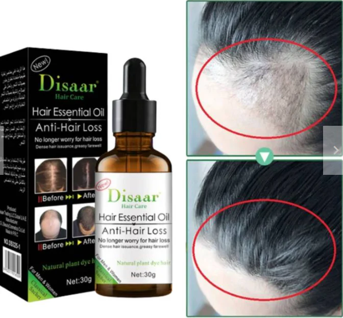 Aceite Anticaída para Cabello – Rellena Zonas Calvas y Engrosa el Pelo – Crecimiento Rápido Visible en Semanas