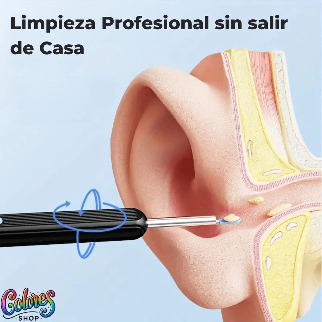 Kit Limpiador de Oídos con Cámara HD y Luz LED | Limpieza Segura y Precisa - Image 4