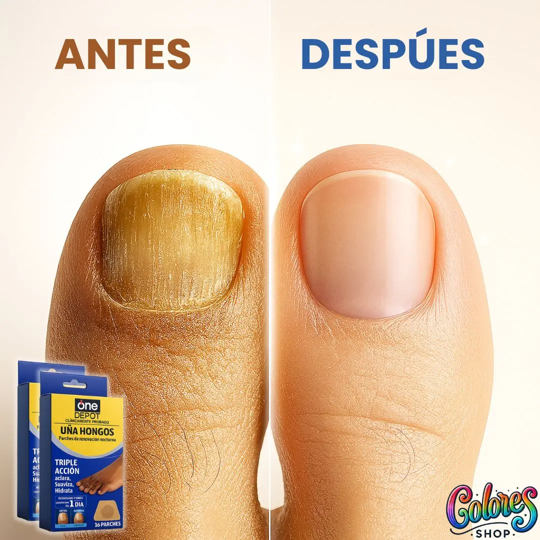 Parches Antihongos para Uñas – Mejora Visiblemente la Apariencia de tus Uñas Mientras Duermes – Tratamiento Fácil, Limpio y Efectivo - Image 2