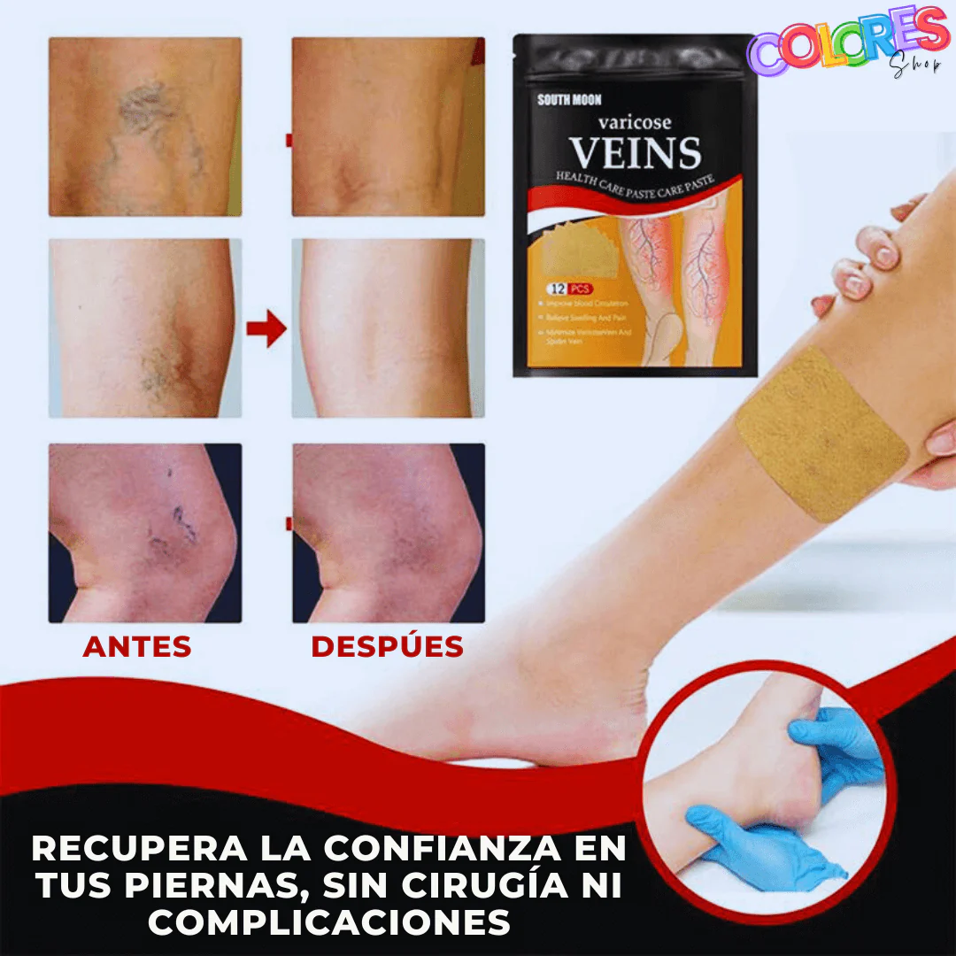 PARCHES PARA EL TRATAMIENTO DE VENAS VARICOSAS/VARICES (24 UNIDADES) - Image 3