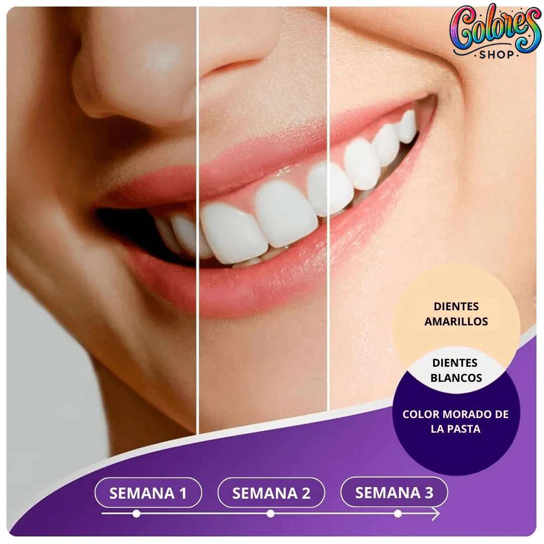 Pasta Blanqueadora para Dientes - Resultados Visibles en Solo 7 Días, Fácil de Usar - Image 2