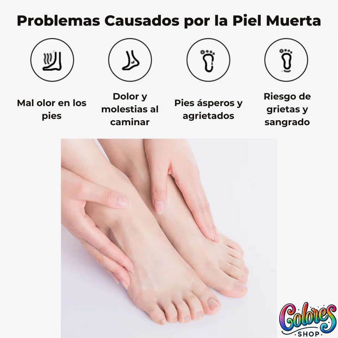 Lima Eléctrica Removedor de Callos Recargable – Elimina durezas sin esfuerzo en casa - Image 3