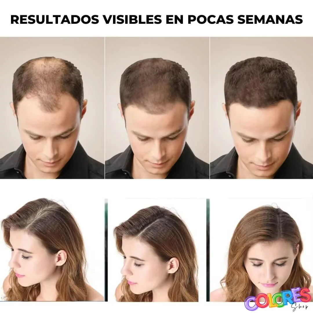 Shampoo Anticaída - Fortalece, Estimula Crecimiento y Protege - Image 2